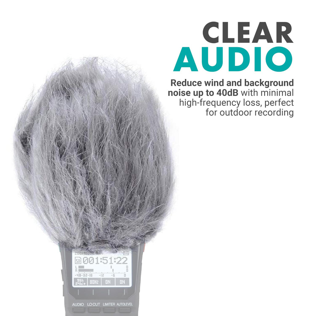 Movo AEK-Z4 Audio Enhancement Kit